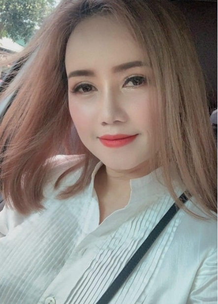 Diện mạo của Hoàng Yến sau khi tháo nẹp mũi