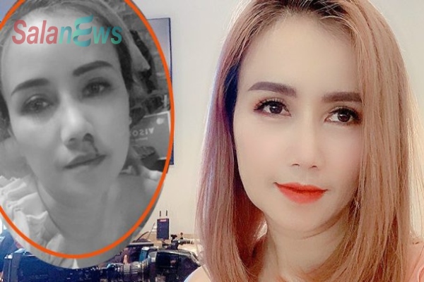 co-xuyen