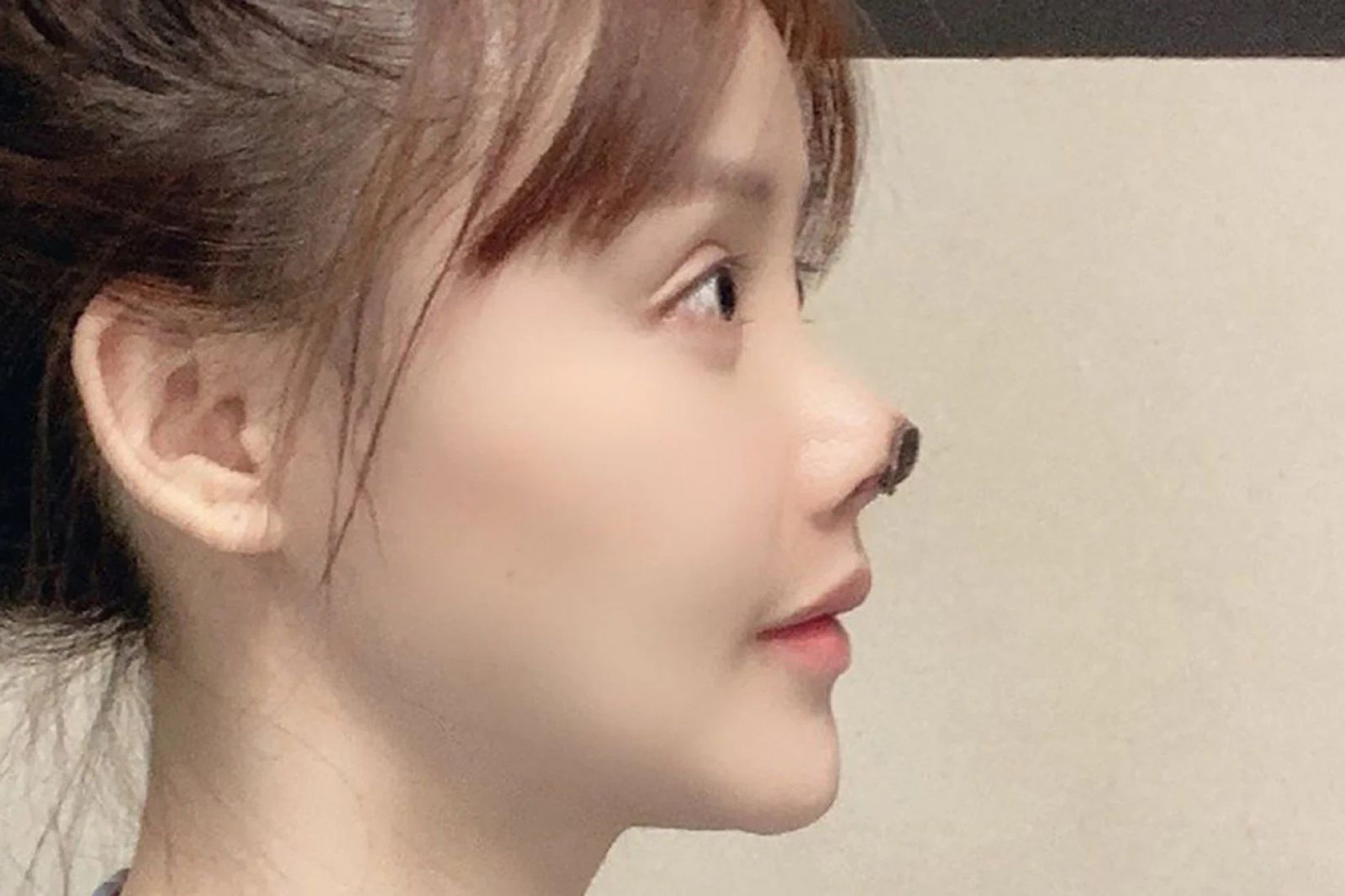 phẫu thuật thẩm mỹ ảnh 4 phau thuat tham my anh 4