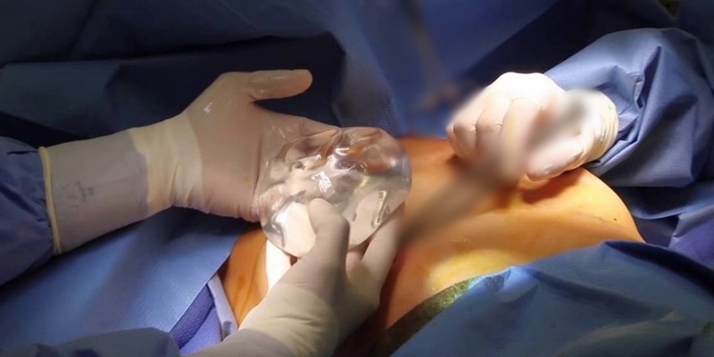  Đã có nhiều sự cố làm đẹp xảy ra. (Ảnh minh họa: Pinterest)