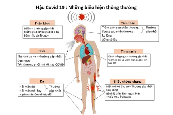 Khoảng 50 triệu chứng hậu COVID: thở gấp, ho, nhức đầu, trầm cảm, và gì nữa?
